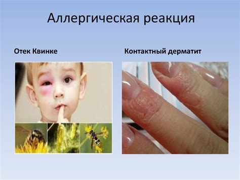 Аллергические реакции на сороконожек