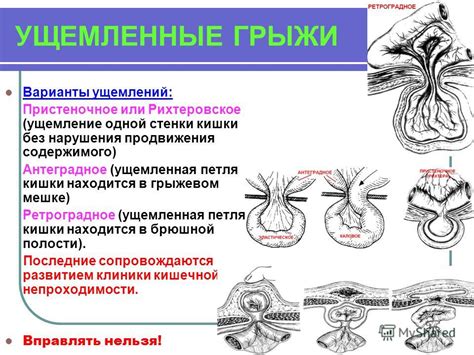 Альтернативные варианты получения отростков без нарушения закона