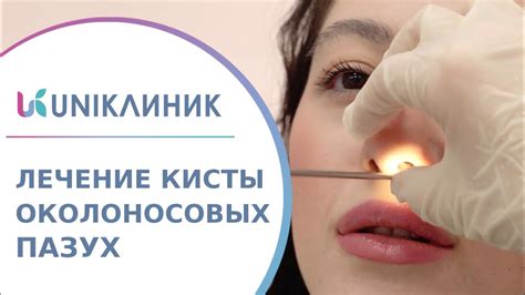 Альтернативные методы лечения кисты в носу