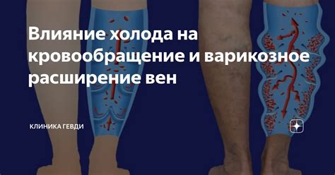 Влияние банок на кровообращение
