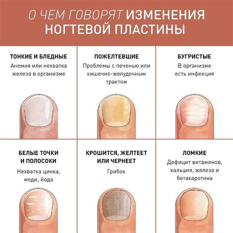 Влияние гормонального фона на состояние ногтей