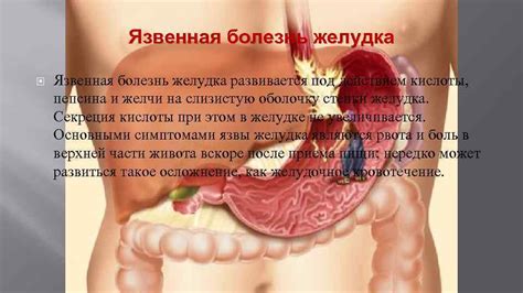 Влияние чабреца на слизистую оболочку желудка