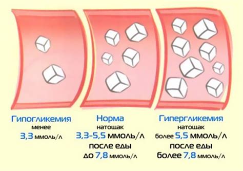 Влияние чёрного хлеба на уровень сахара в крови при диабете