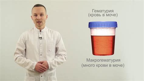 Возможные причины темной мочи при приеме "Карсила"