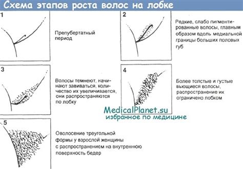Гены и цвет волос на лобке