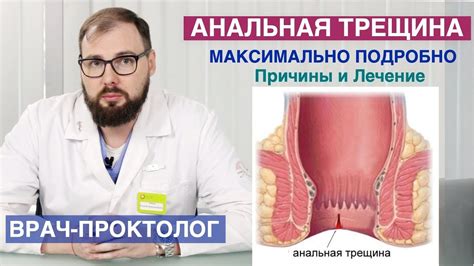 Как долго продержится заклеенная трещина