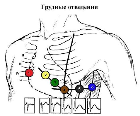Как правильно провести ЭКГ при плаче ребенка