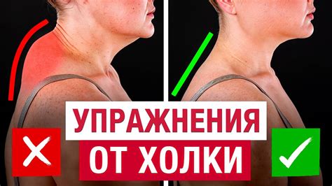 Как убрать холку на шее скалкой