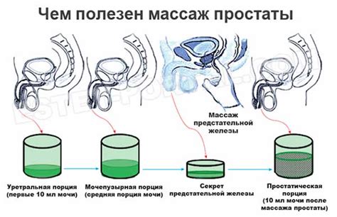 Массаж простаты и ислам: вопросы религии