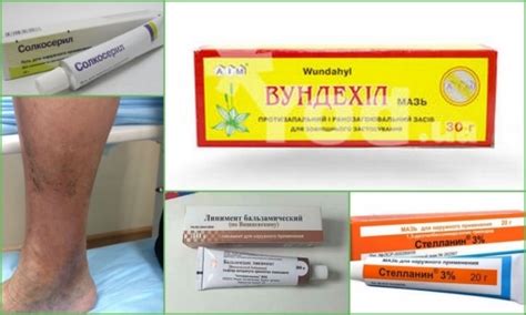 Нюансы мытья трофической язвы хозяйственным мылом