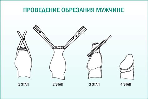 Обрезание и памперс