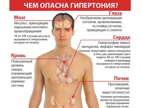 Определение и симптомы гипертонии