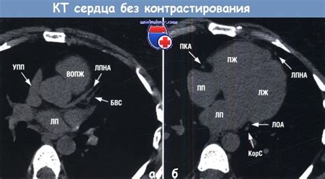 Основные риски ношения сережек на КТ