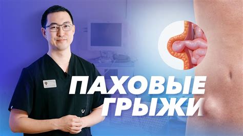 Подтягивания и паховая грыжа: риски и возможности