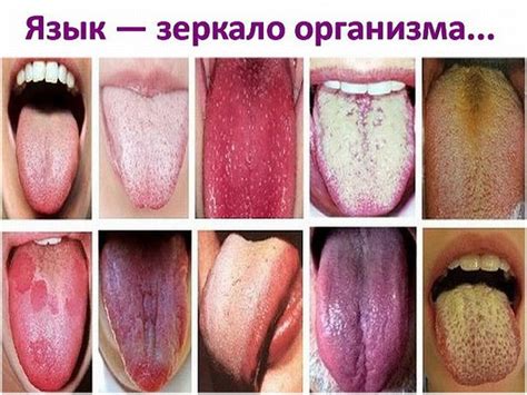 Последствия откусывания языка