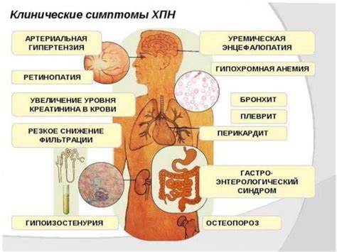 Почечная недостаточность и ее симптомы