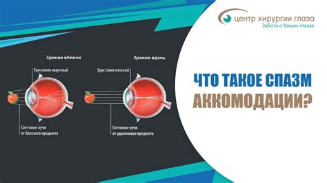 Предотвращение напряжения глаз