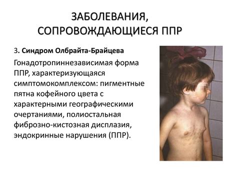 Преждевременное возвращение ребенка
