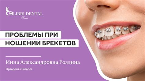 Преимущества использования Дарсонваля при ношении брекетов