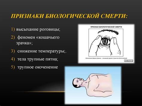 Признаки неизбежной смерти