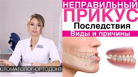 Причины неправильного флюорографического снимка