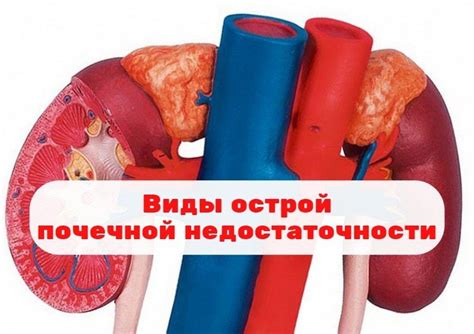 Причины почечной недостаточности