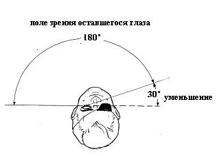 Профессиональная адаптация слесарей с одним глазом