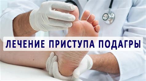 Рекомендации врачей по применению аденурика при обострении подагры