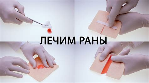 Рекомендации по использованию зеленки для обработки ран