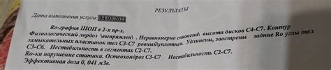Рекомендации по совместному применению комбилипена и никотиновой кислоты