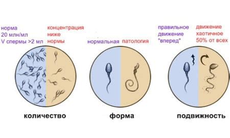 Связь между витилиго и зачатием у мужчин
