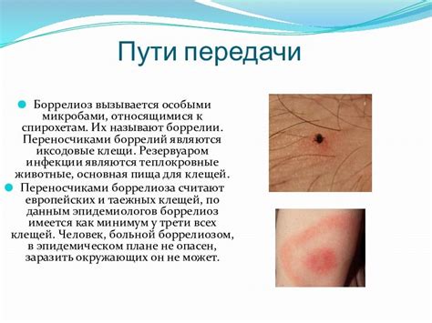 Симптомы заражения паразитами, относящимися к копченой скумбрии