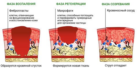 Симптомы и последствия ожога от горячего обертывания