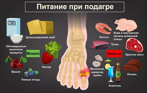 Симптомы обострения подагры