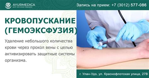 Существующие методы кровопускания