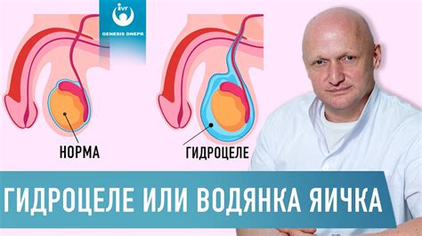 Увеличение размера яичек: что происходит при воздержании у мужчин