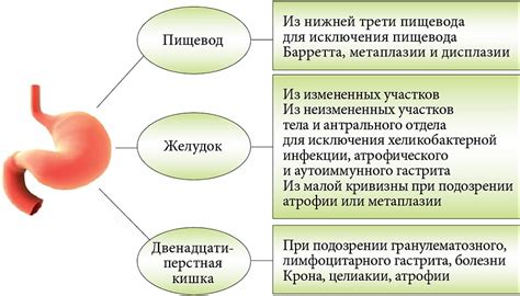 Укрепление слизистой оболочки желудка с полынью