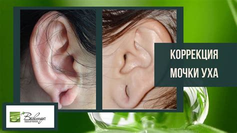 Уход за закрытой мочкой уха