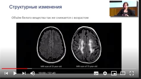 Что происходит с скобами